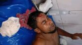 দুমকিতে পারিবারিক বিরোধে কুপিয়ে জখম