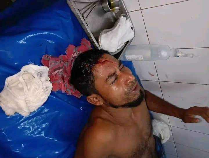 দুমকিতে পারিবারিক বিরোধে কুপিয়ে জখম