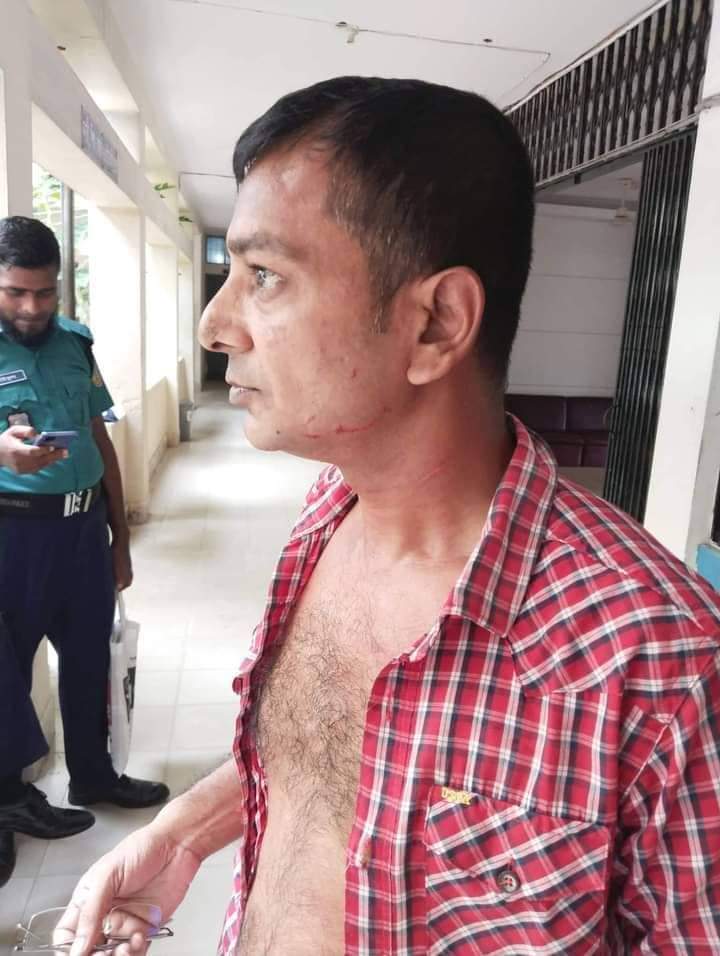 বরিশালে  সাংবাদিক শফিউর রহমান কামাল সন্ত্রাসী হামলার শিকার