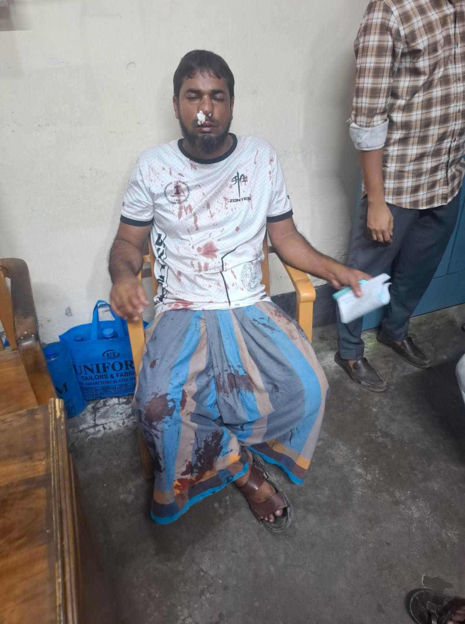 পাথরঘাটা কলেজ মাঠের পানি নিষ্কাশন নিয়ে বিরোধ, কলেজ চত্বরে ব্যবসায়ীর নাক ফাটিয়ে দেয়ার অভিযোগ শিক্ষকদের বিরুদ্ধে 